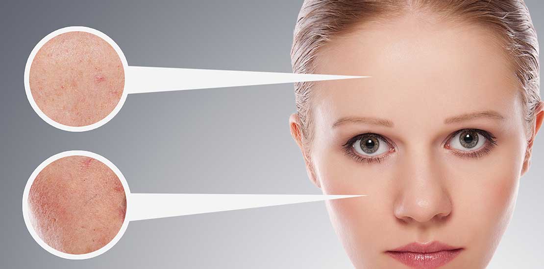 Soins du visage : restez attentives aux exigences de votre peau